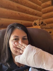 Woman with a broken wrist after a nighttime bike crash in the Snowy Range Mountains, sharing why she now packs a rechargeable headlamp for biking and camping.